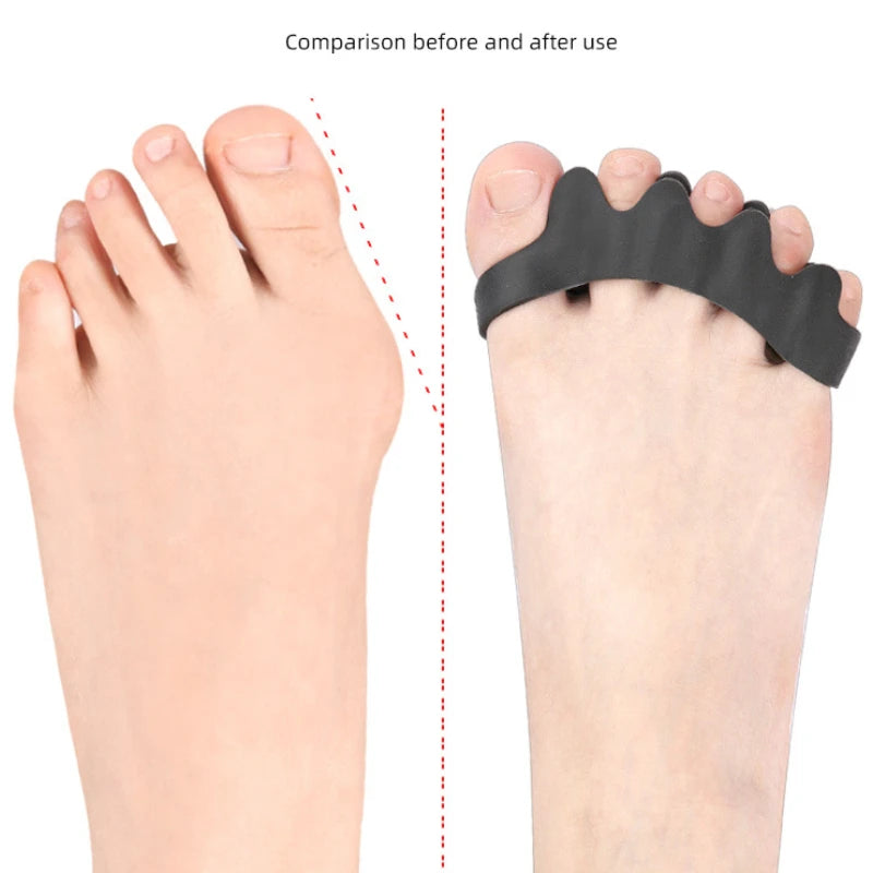 Comfort Toe Separators
